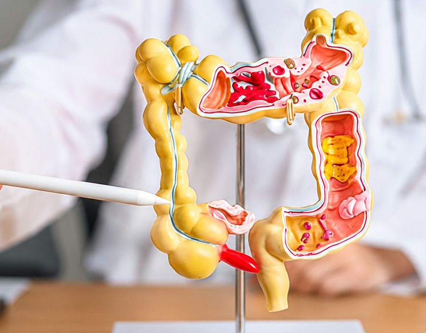 Screening colon-retto: un piccolo gesto di prevenzione