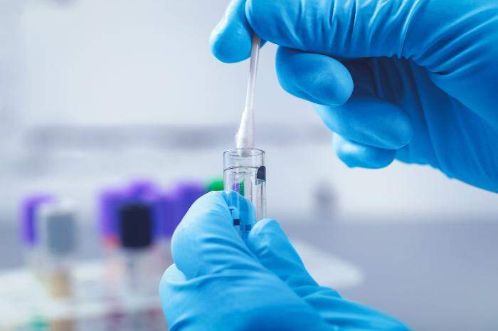 Tamponi microbiologici: quali sono, quando farli e come prepararsi